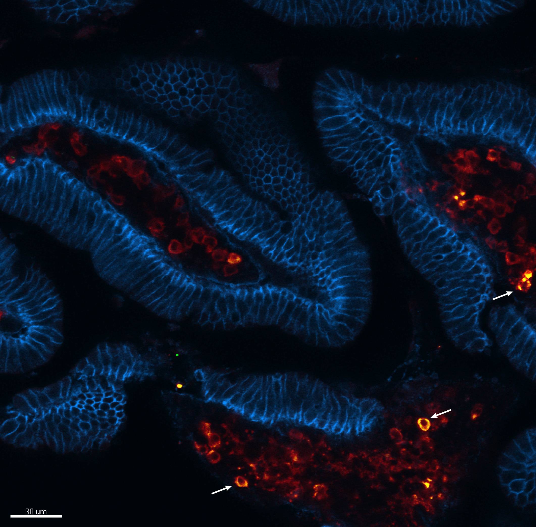 Small intestine villi